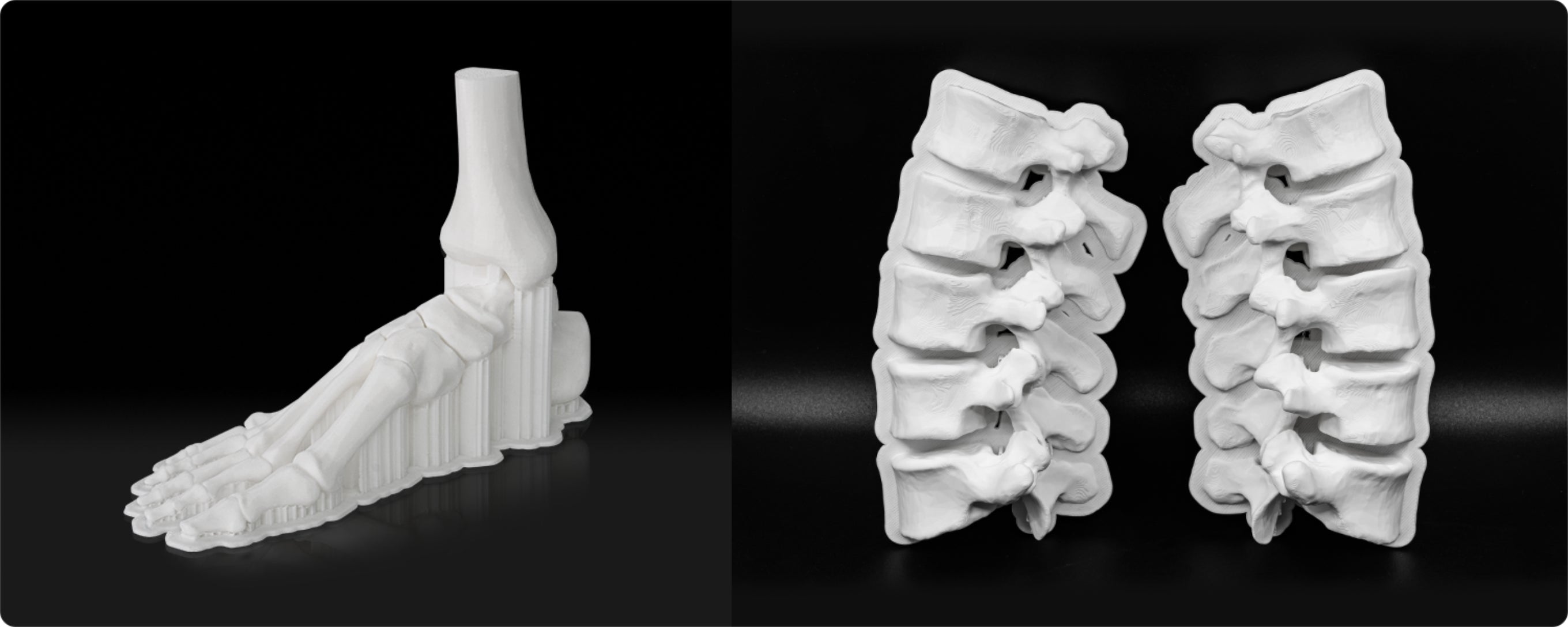 Medical Model