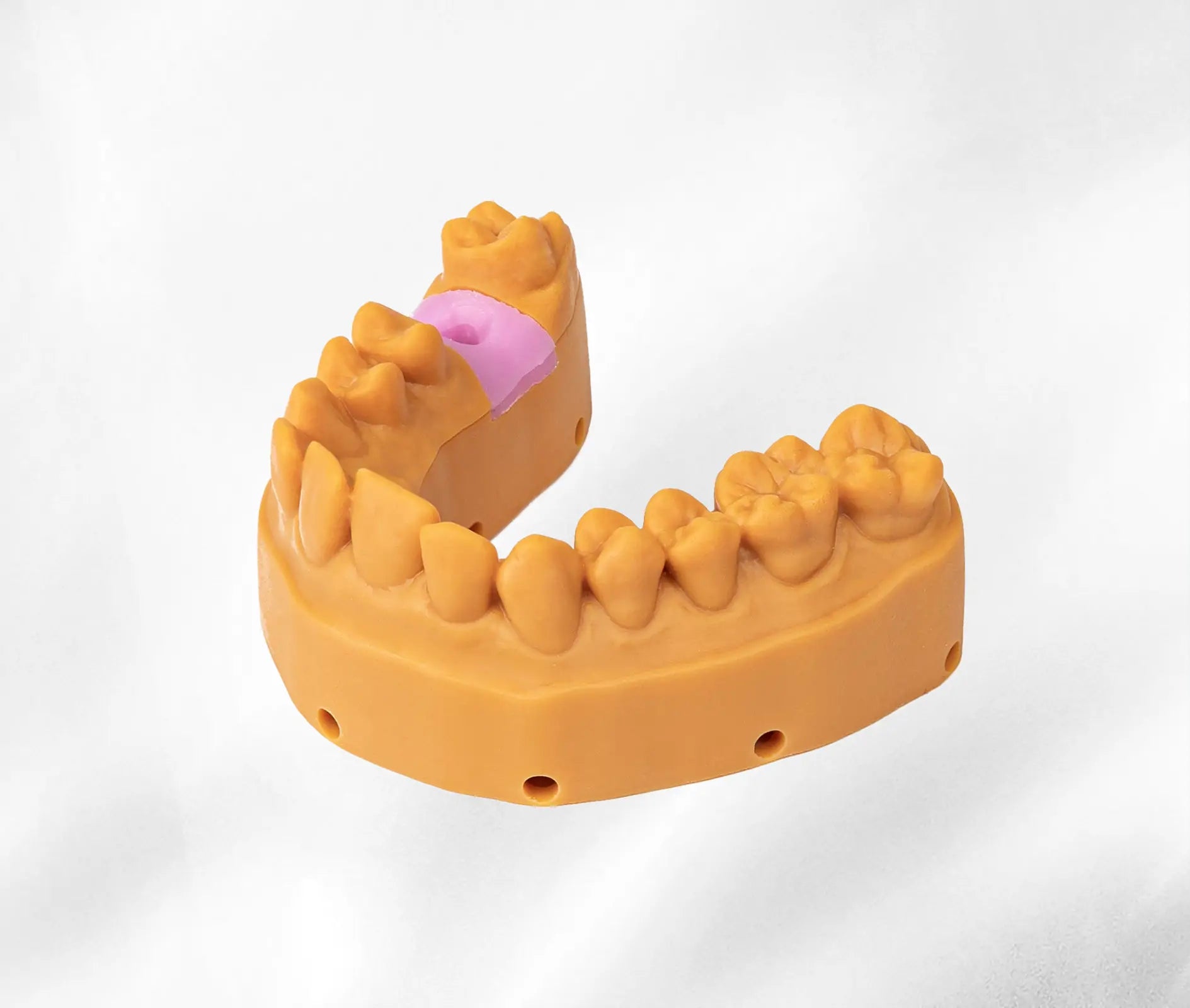 Denture Framework